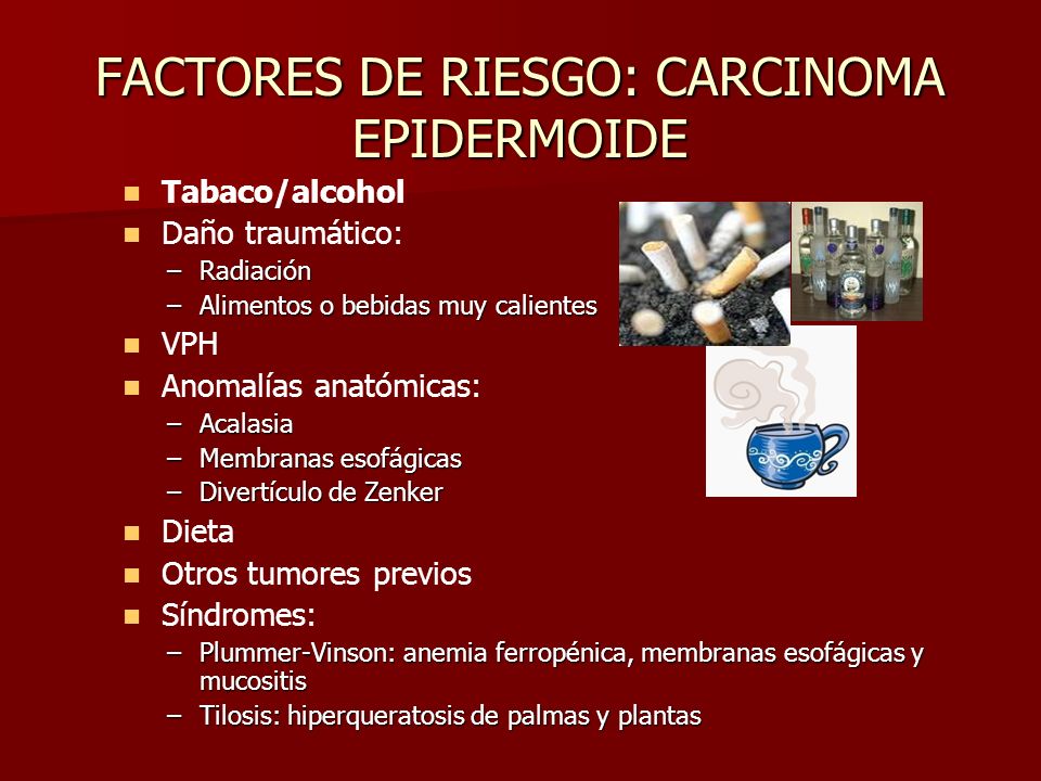 carcinoma epidermoide gastrico
